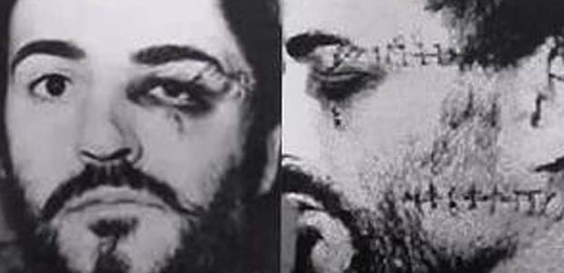 Peter-Sutcliffe-Attack-by-James-Costello